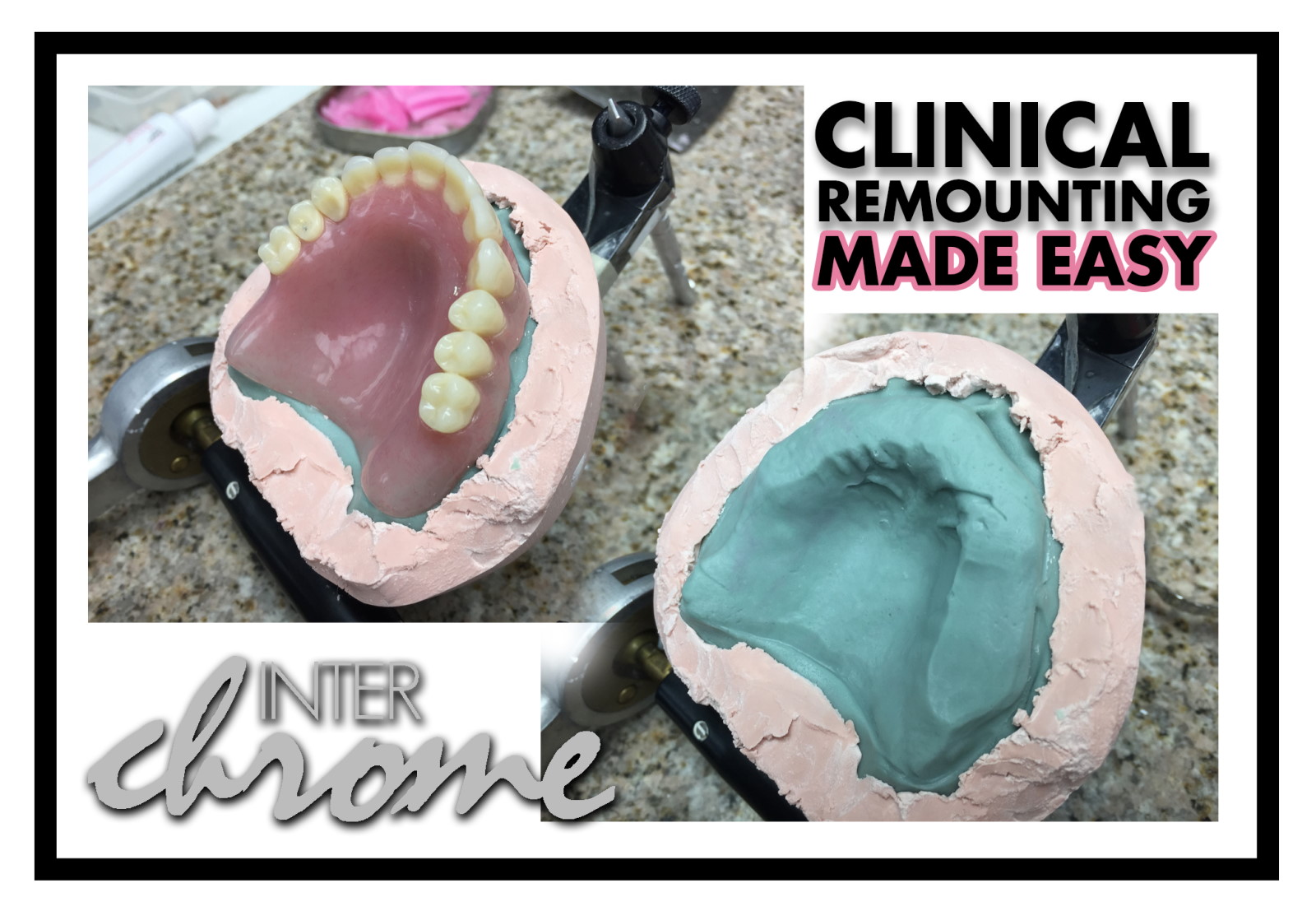 Clinical Remounting Made Easy Blog Header