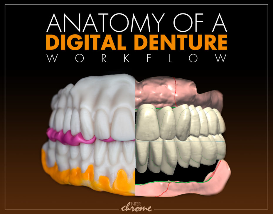 denture digital anatomy workflow dental lab