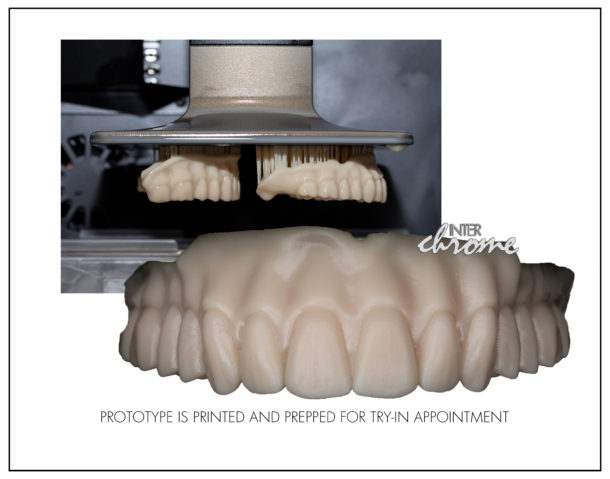 Anatomy Of A Digital Denture Workflow - InterChrome Dental Lab