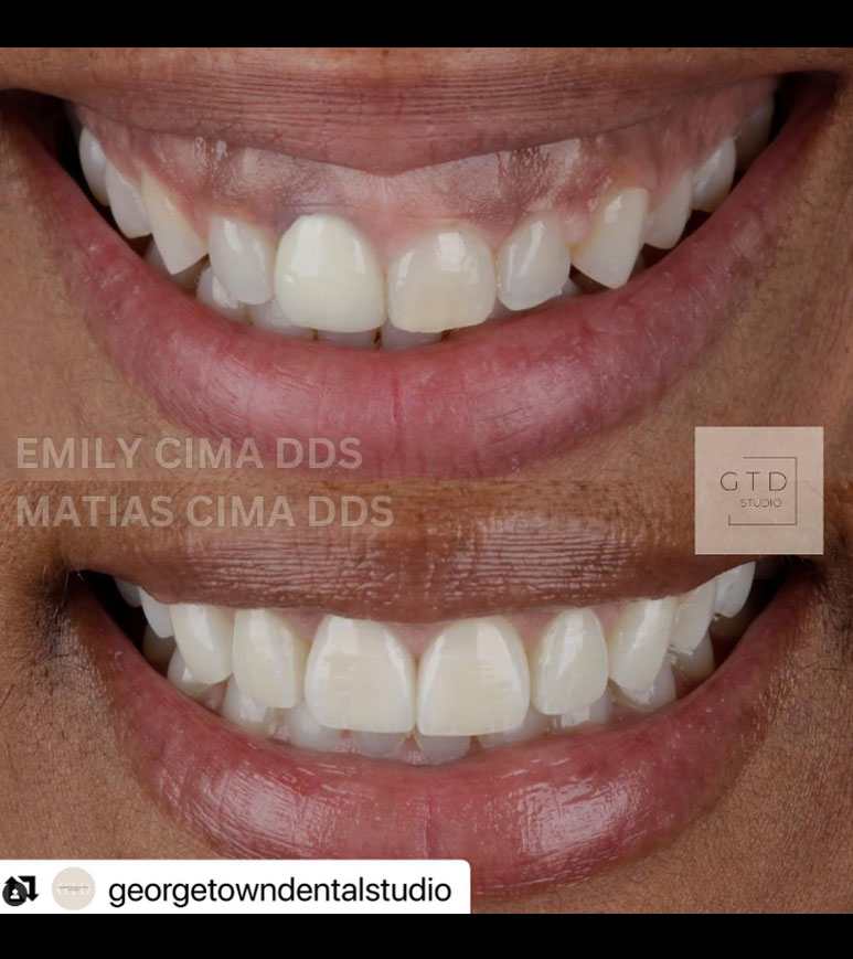 smile transformed inter-chrome dental