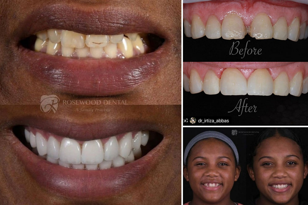 before after gallery collage interchrome dental lab