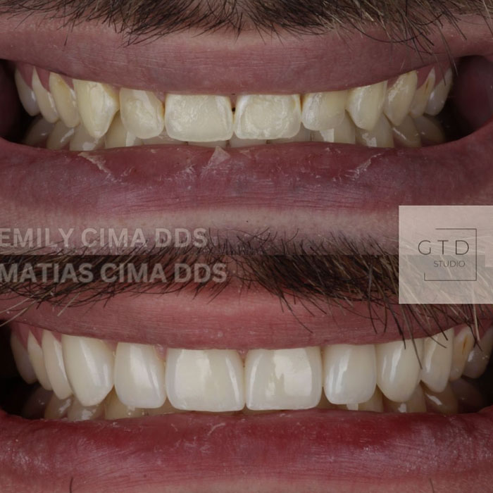 smile transformed inter-chrome dental